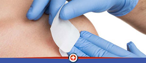 Incisions and Drainage of Abscesses and Hematomas in Cincinnati, OH